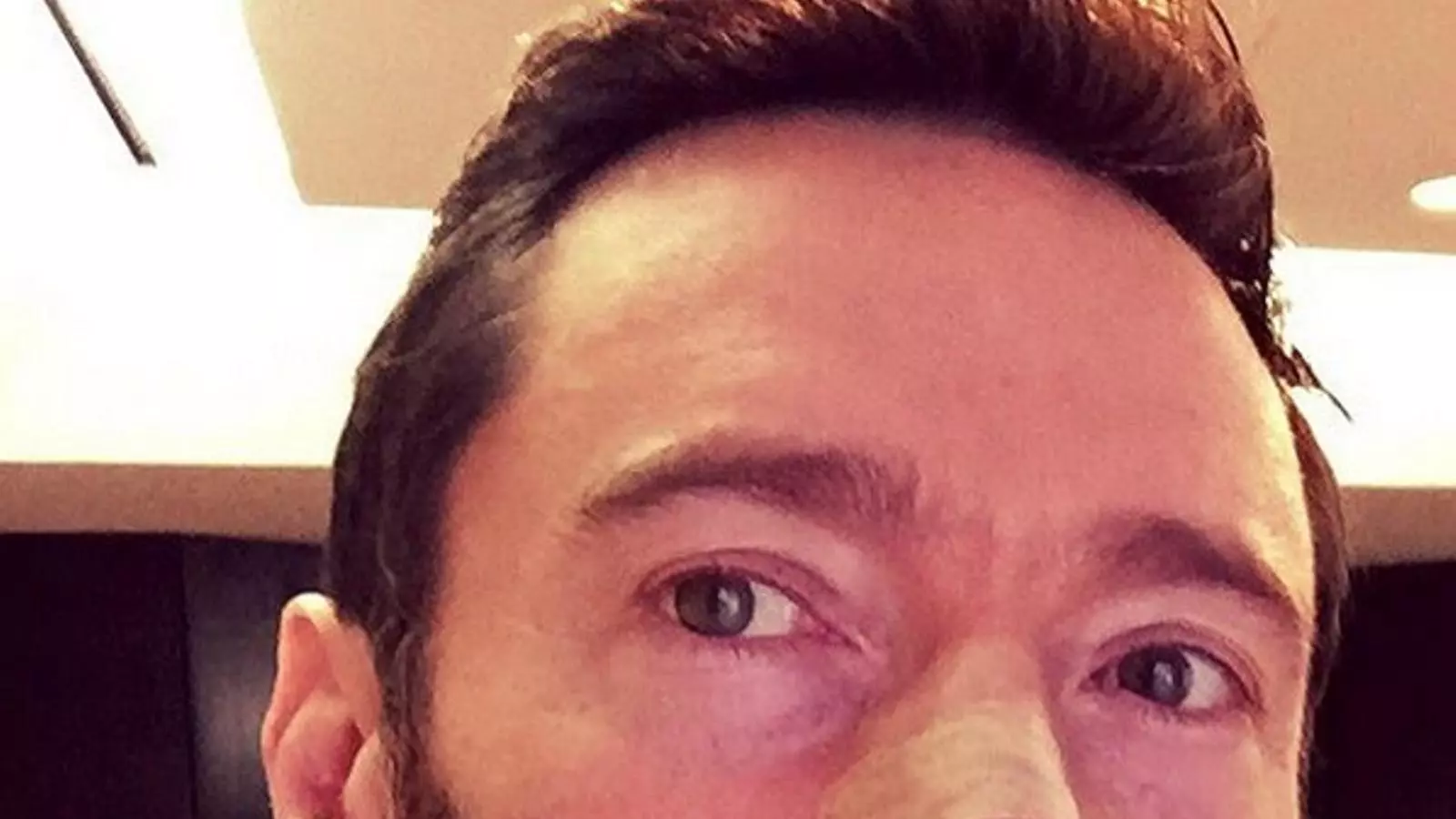 Hugh Jackman explica que ha estat operat per cinquè cop d'un carcinoma / INSTAGRAM