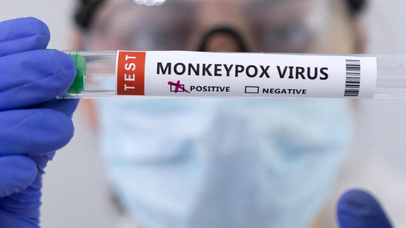 Virus de la Verola del mono