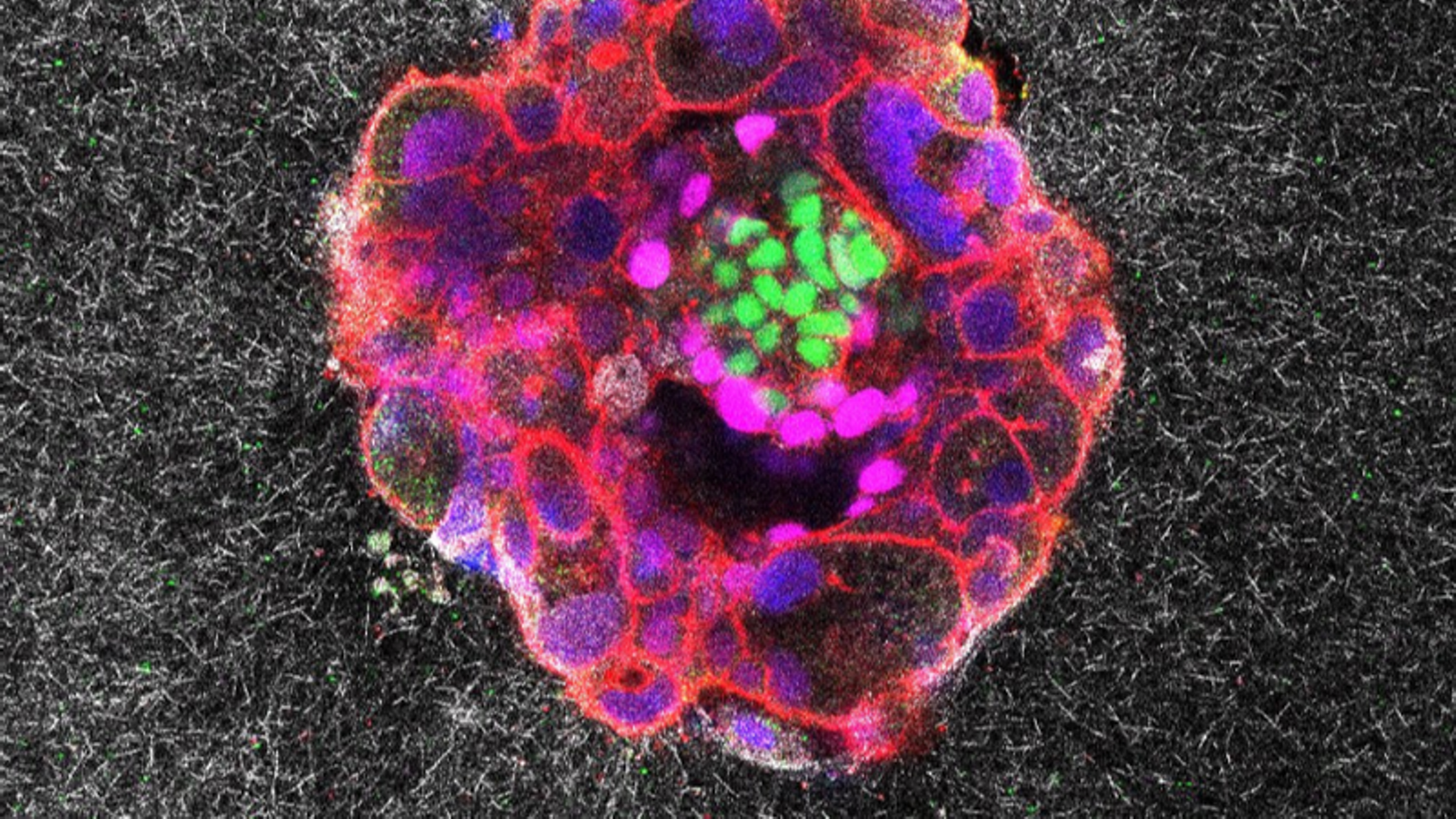 Microscopic image of a nine-day-old human embryo.