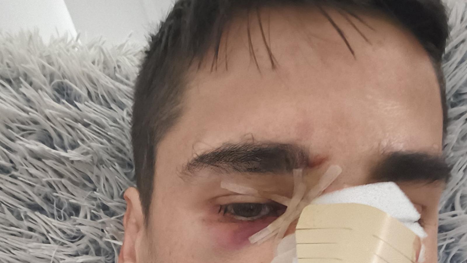 Fonsi Loaiza, after the aggression.