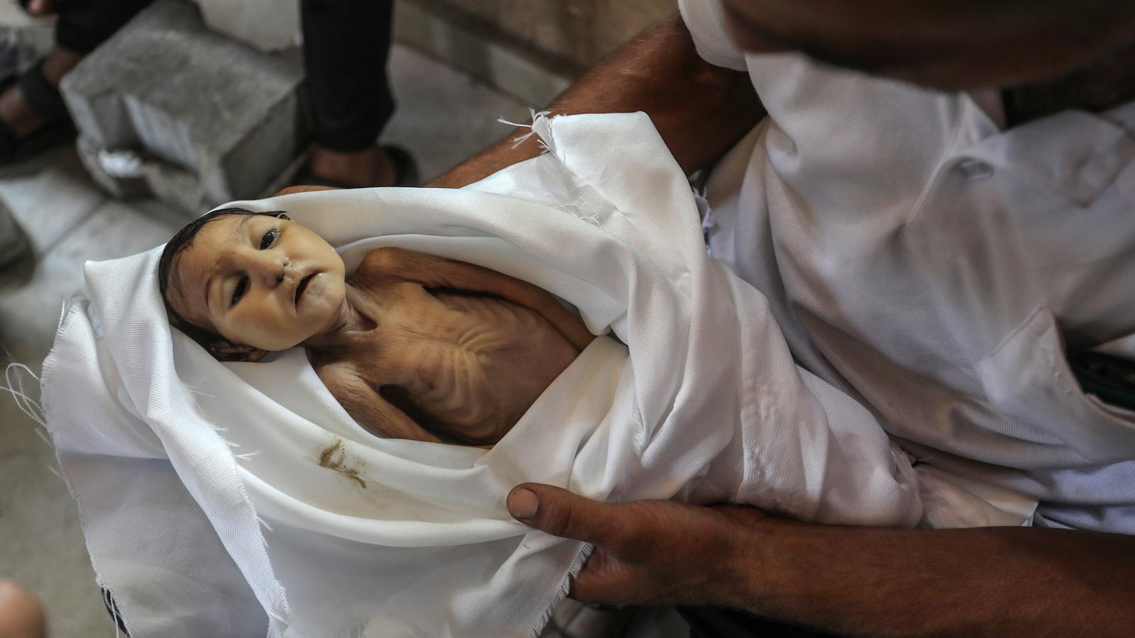 The father of five-month-old Ghadeer Brika holds her lifeless body at the Nasser Medical Complex in Khan Yunis, in the southern Gaza Strip. She died after suffering from severe malnutrition.