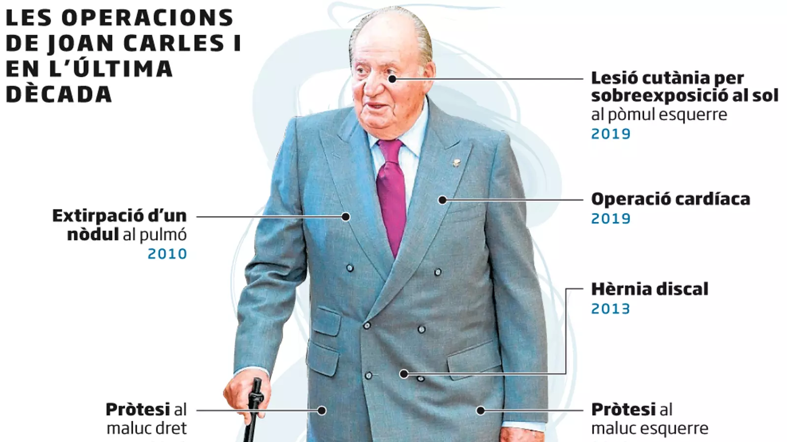 Joan Carles I serà operat del cor dissabte