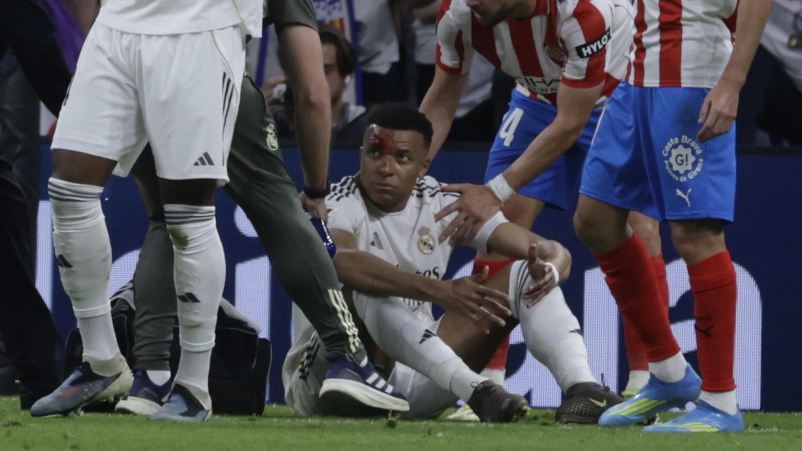 Mbappé con un corte en la ceja, después del golpe de Vitor Reis