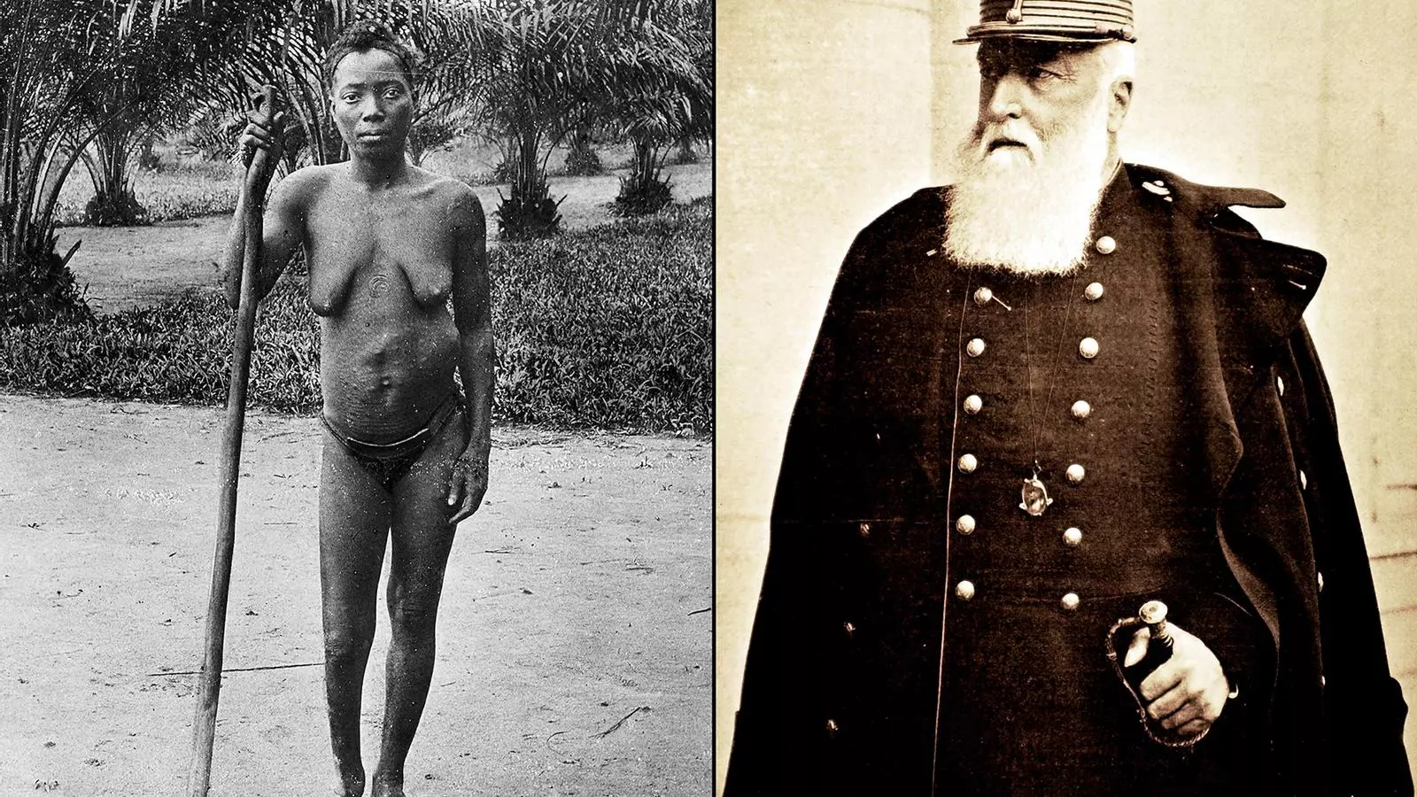 Una dona congolesa sense identificar mostrant el peu amputat, un càstig per no haver arribat a la quota de producció exigida pels colons. Es desconeix quan i on es va fer la imatge / Últim retrat oficial del rei Leopold II de Bèlgica, datat del 1909, l’any de la seva mort al castell reial de Laeken, a la regió de Brussel·les / GETTY