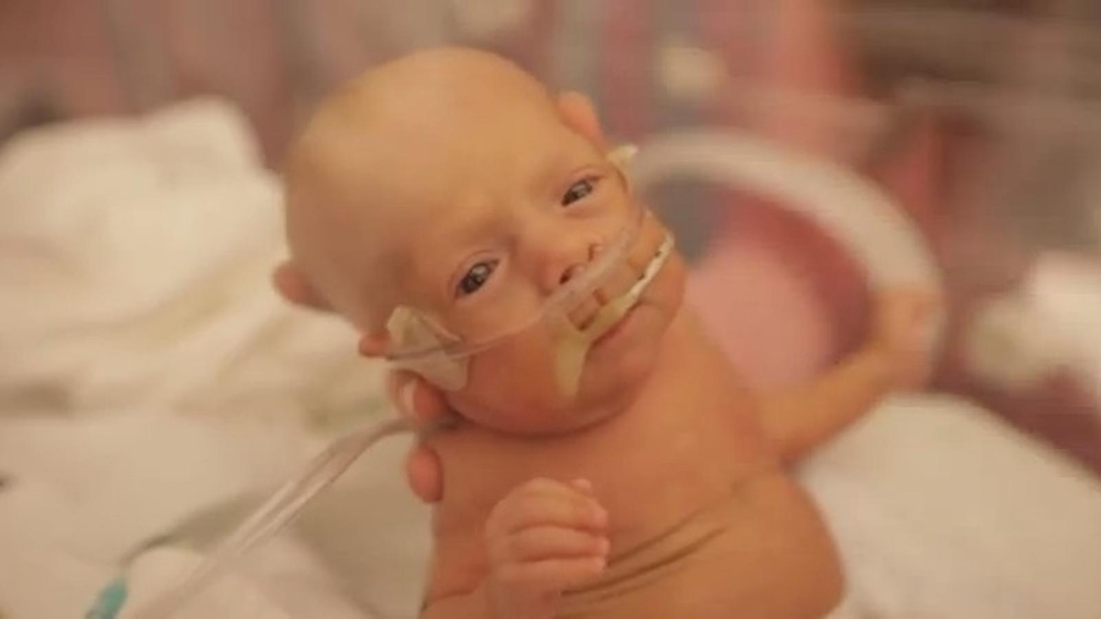 Internet s'emociona amb el vídeo que celebra el primer any de vida d'un nen prematur