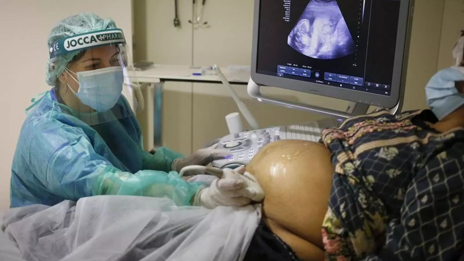 A doctor performing an ultrasound on a covid -19 positive pregnant patient at the Vall d'Hebron hospital during the third wave
