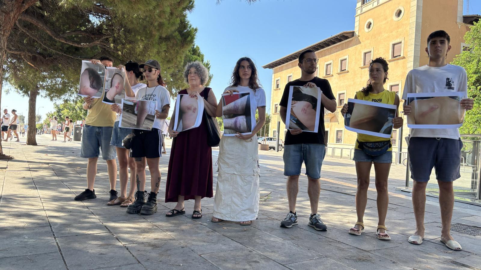 Pressekonferenz von Weniger Tourismus, Mehr Leben zur Ankündigung der Anzeigen wegen Körperverletzung durch Beamte