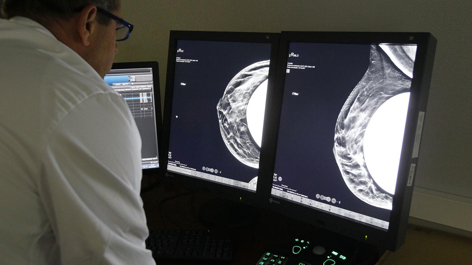 A doctor looking at a mammogram to detect breast cancer at Son Espases hospital.