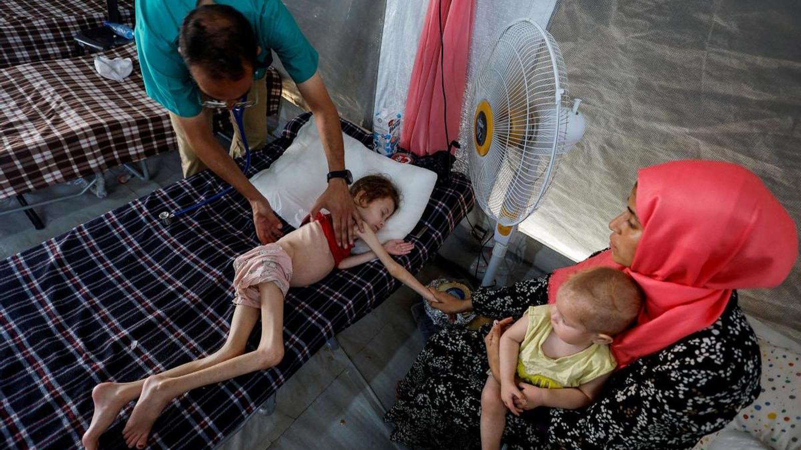 A doctor examines Jana Ayad, a malnourished Palestinian girl, at an International Medical Corps field hospital in Deir Al-Balah, southern Gaza.