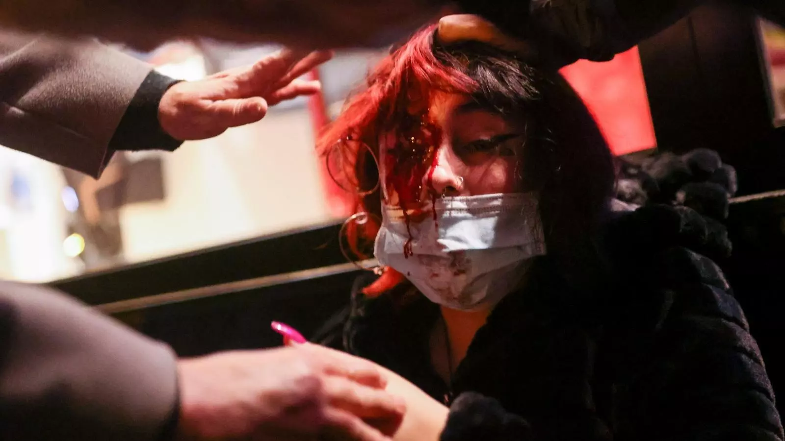 Image of the woman wounded by a foam bullet fired by the Mossos