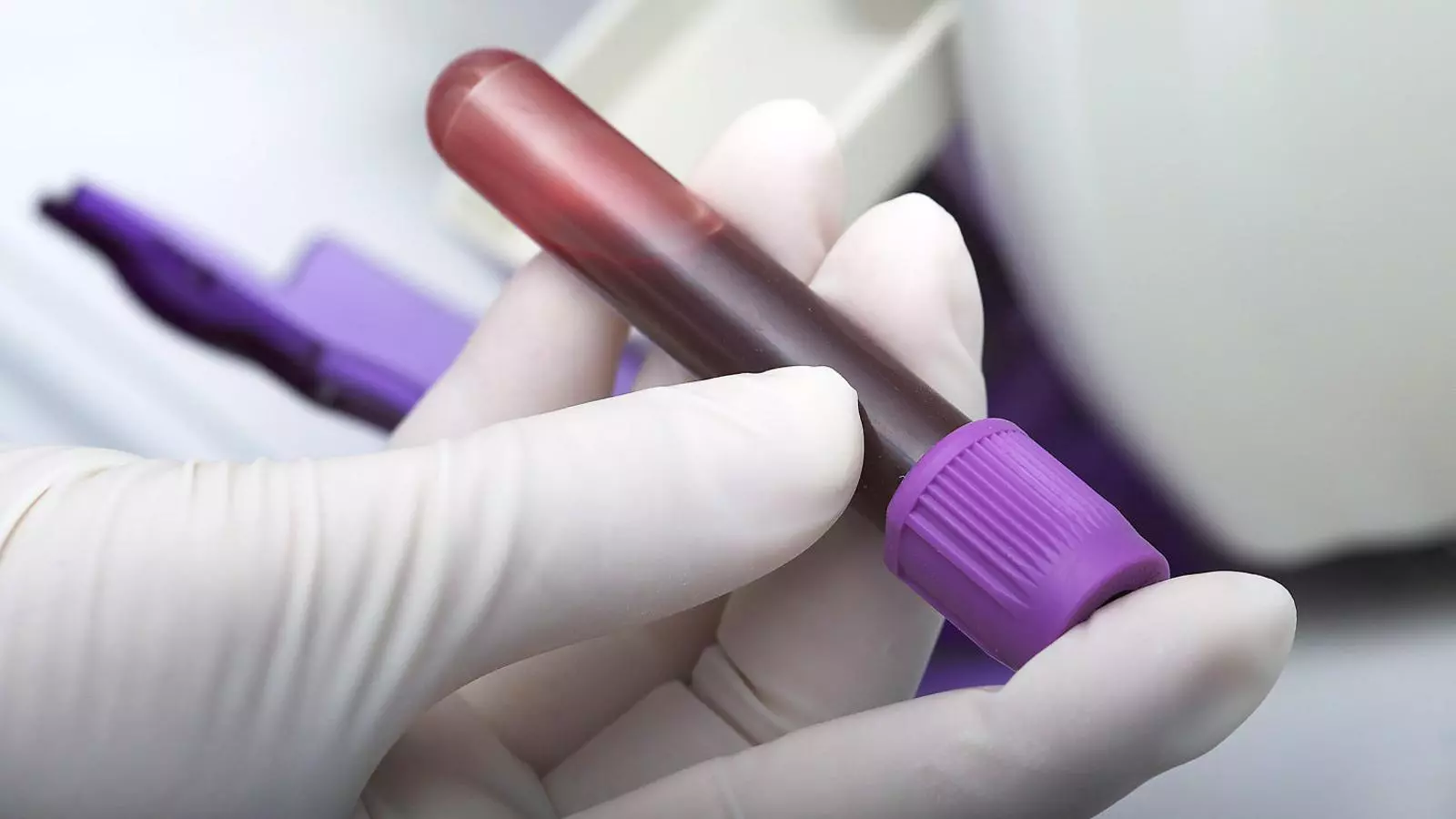Una mostra de sang podria ser suficient per a la detecció precoç del càncer. El sistema, però, és una bateria de tests d’una extrema complexitat.