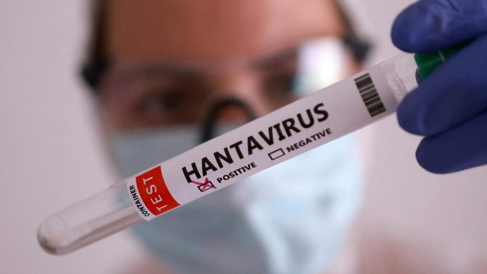A healthcare worker shows a positive hantavirus sample.