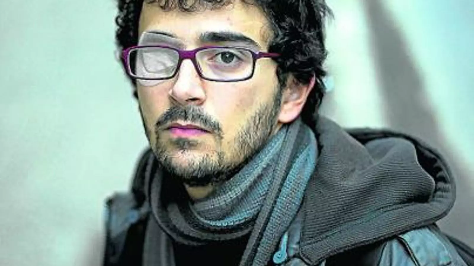Nicola Tanno va patir una lesió a l’ull provocada per una pilota de goma l’any 2010 a Barcelona.