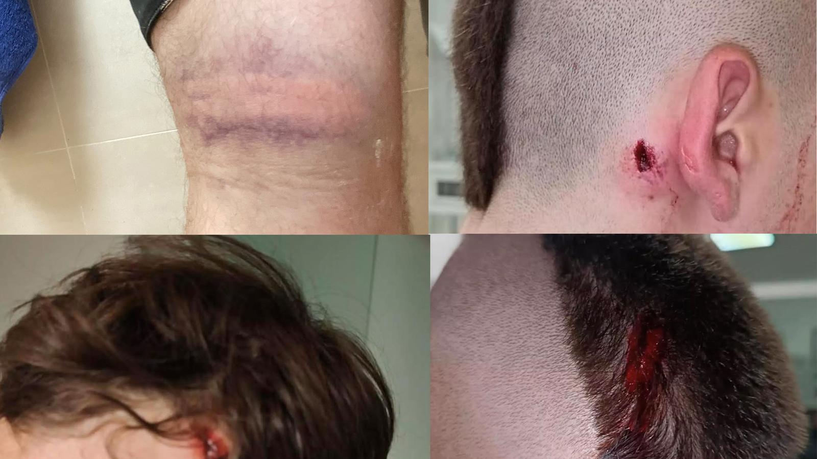 Personas heridas durante las cargas policiales
