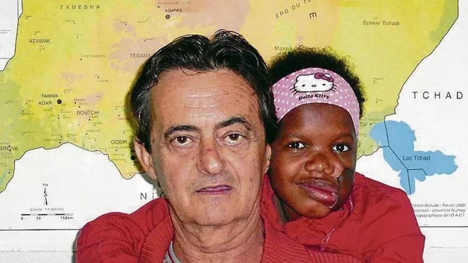 Pep Campaner ha fat possible que nins i nines afectats de noma puguin ser operats