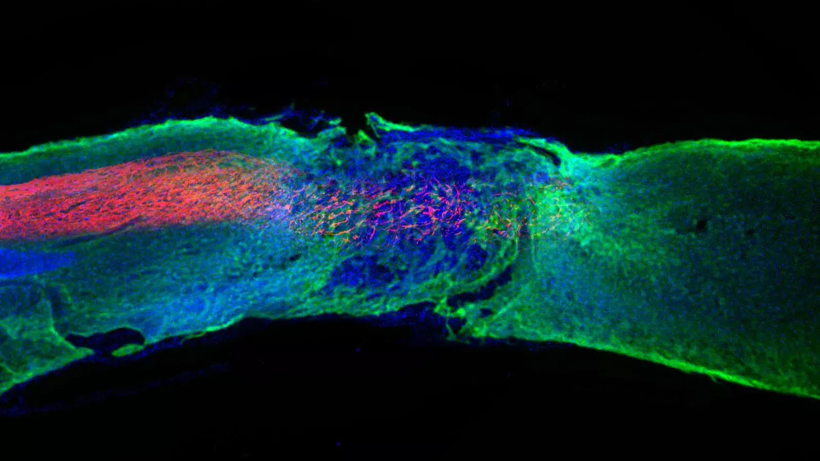 Las nanofibres como las de la imagen han conseguido hacer andar ratones con lesiones medulars graves