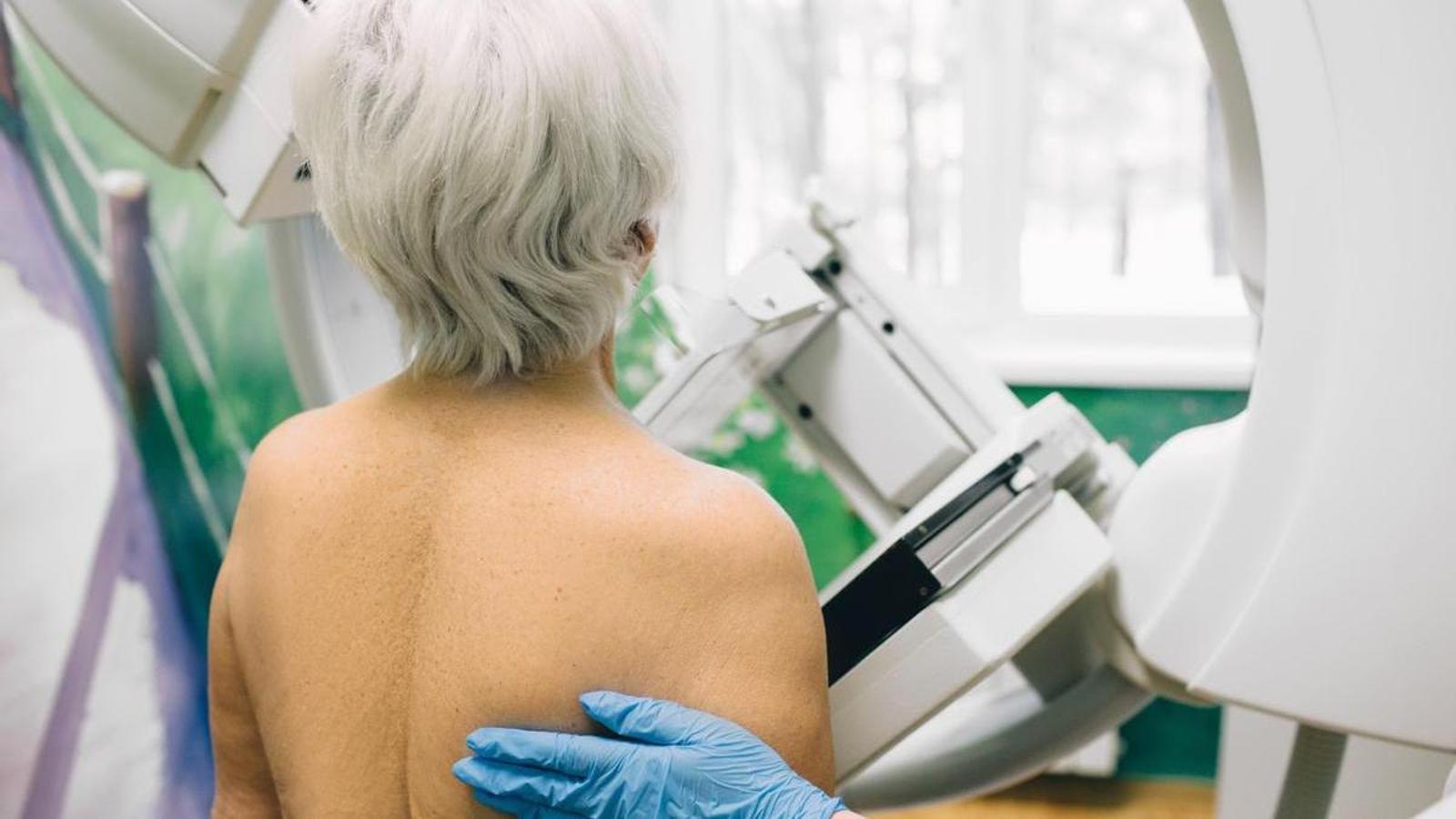 Una mujer se hace una mamografía en un hospital, en una imagen de archivo.