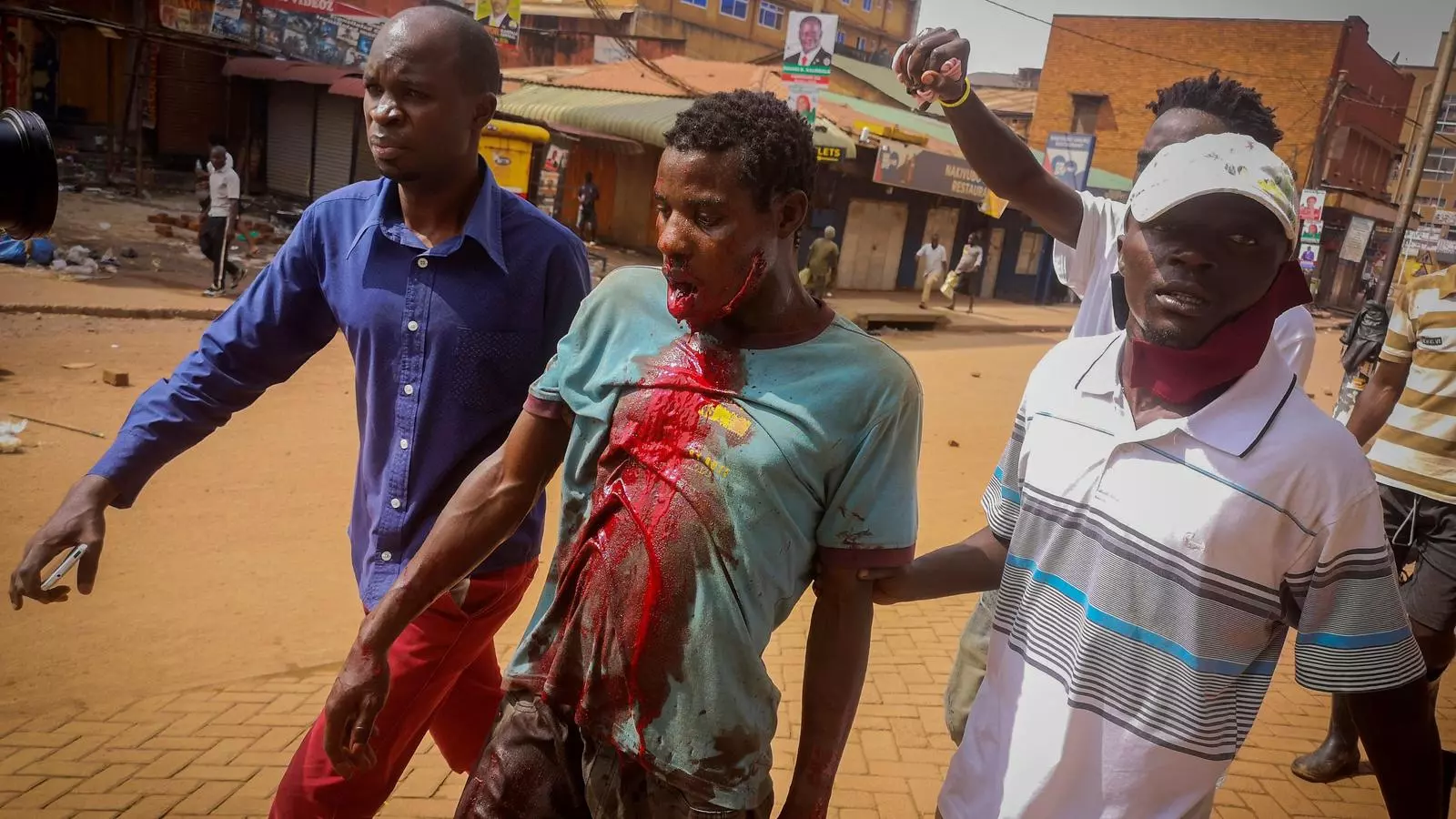 Un dels manifestants ferits en les protestes a Uganda contra la detenció del candidat opositor Bobi Wine