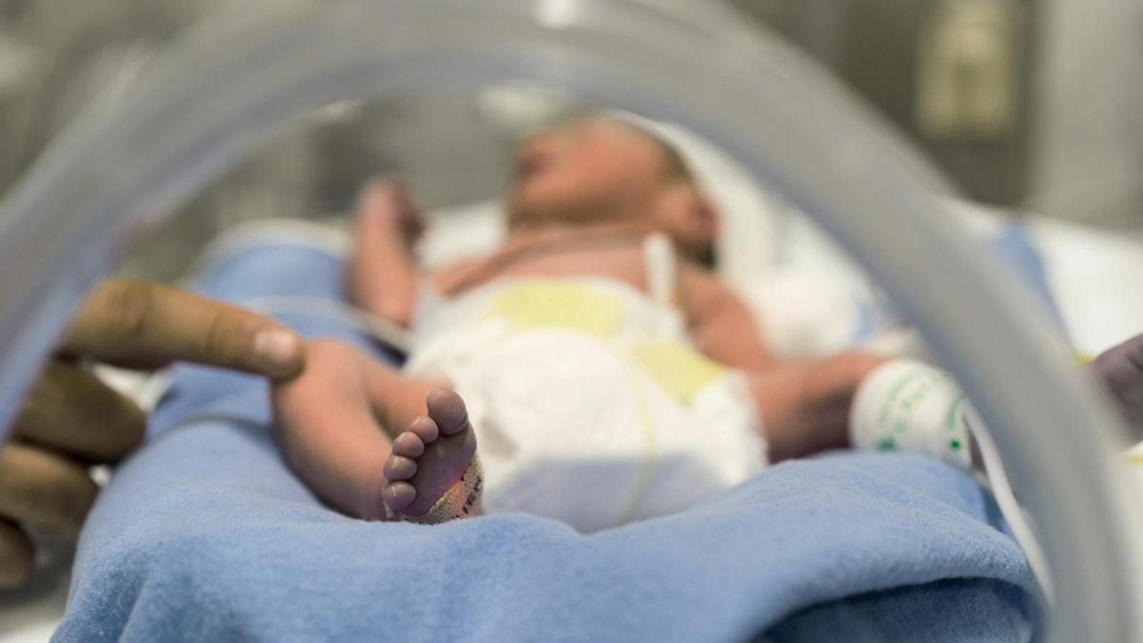 A premature baby in an incubator.