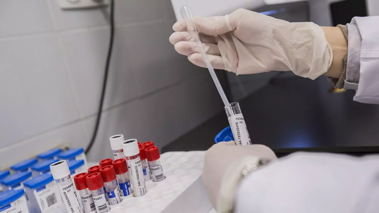 El laboratori permet donar els resultats del diagnòstic de malalties de transmissió sexual en 3 hores