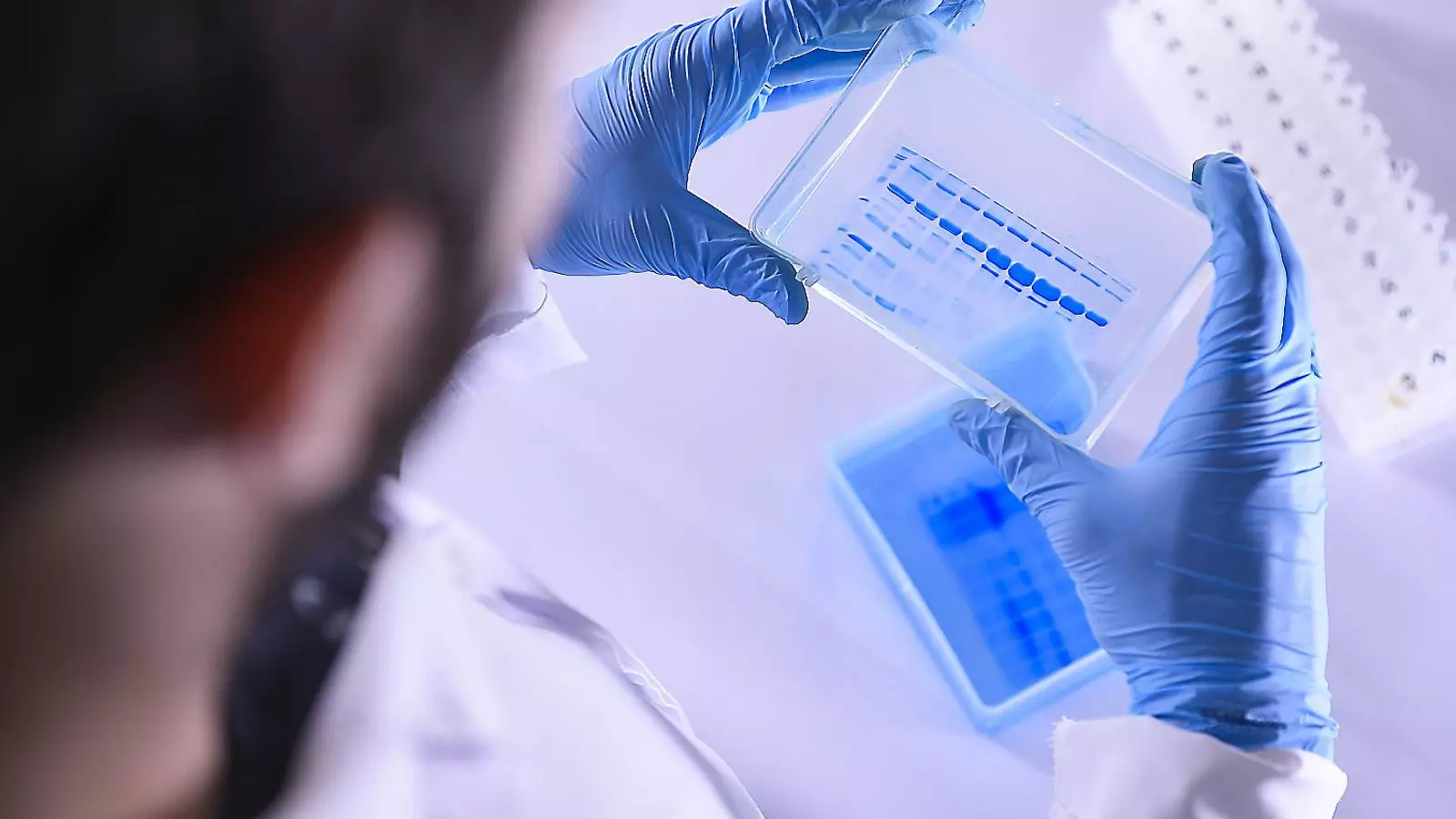 Anàlisi d’antigens amb un gel en un laboratori on es fa recerca per a la vacuna.